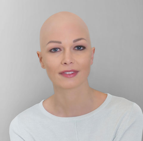 ContactSkin - Janin vorher | Haarcenter Hess Zweithaarspezialist in Rosenheim