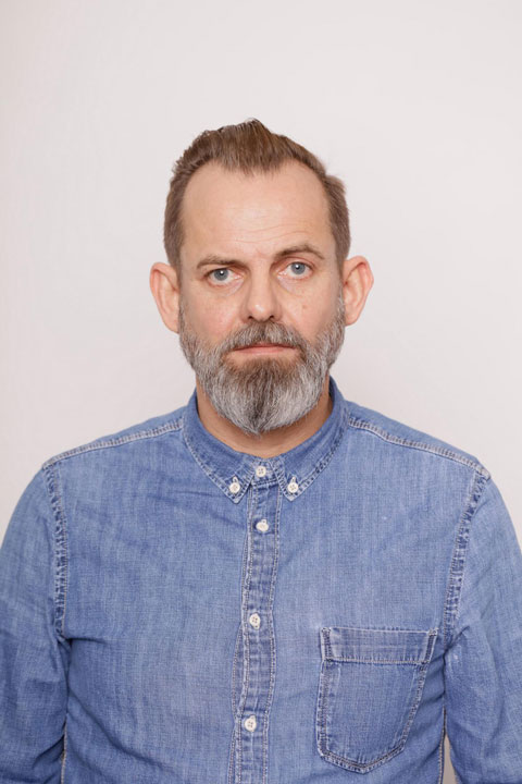 ContactSkin - Geheimratsecken 1 | Haarcenter Hess Zweithaarspezialist in Rosenheim