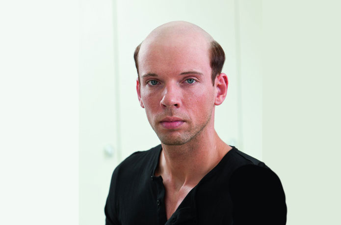 Glatze adé im Haarcenter Hess in Rosenheim - Ihrem Zweithaarspezialist