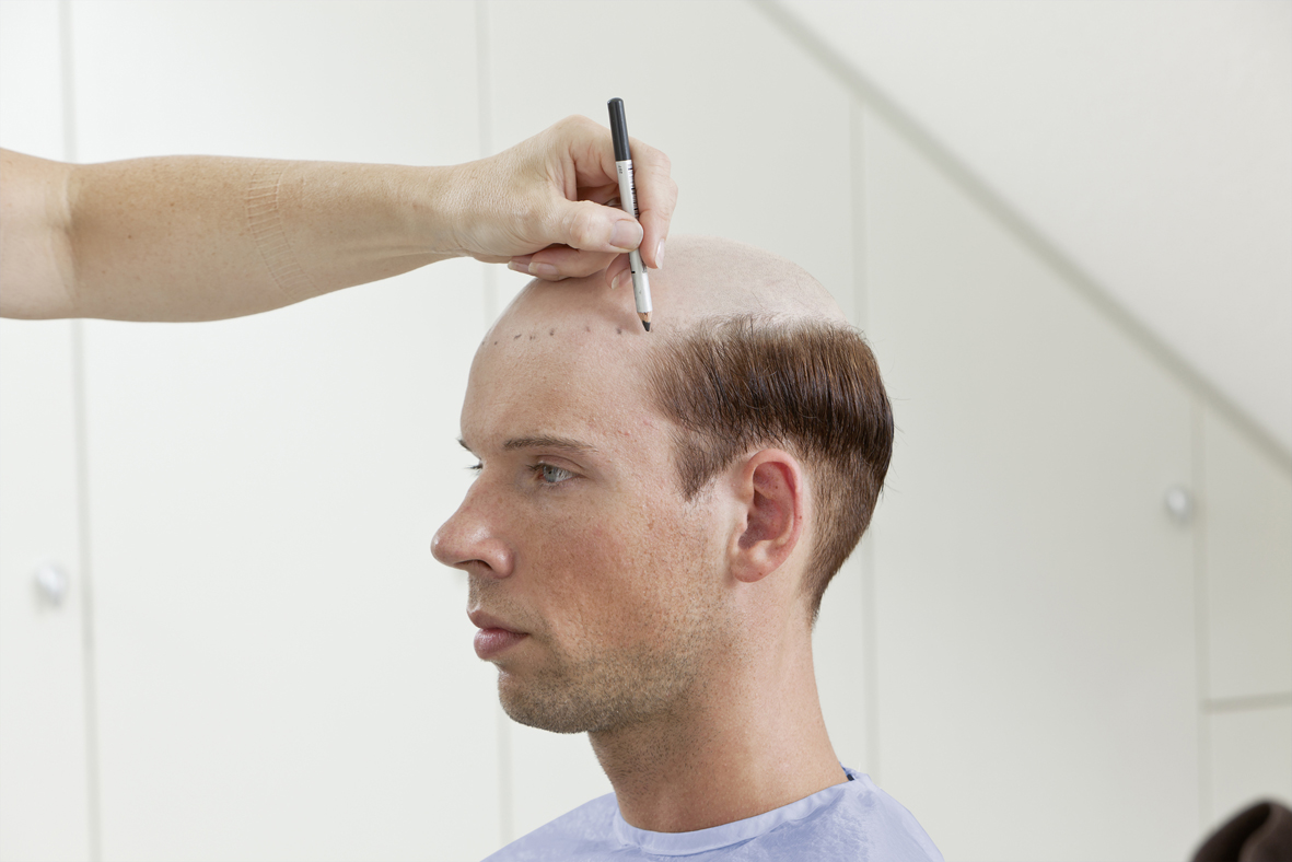 ContactSkin - Schritt 2 | Haarcenter Hess Zweithaarspezialist in Rosenheim