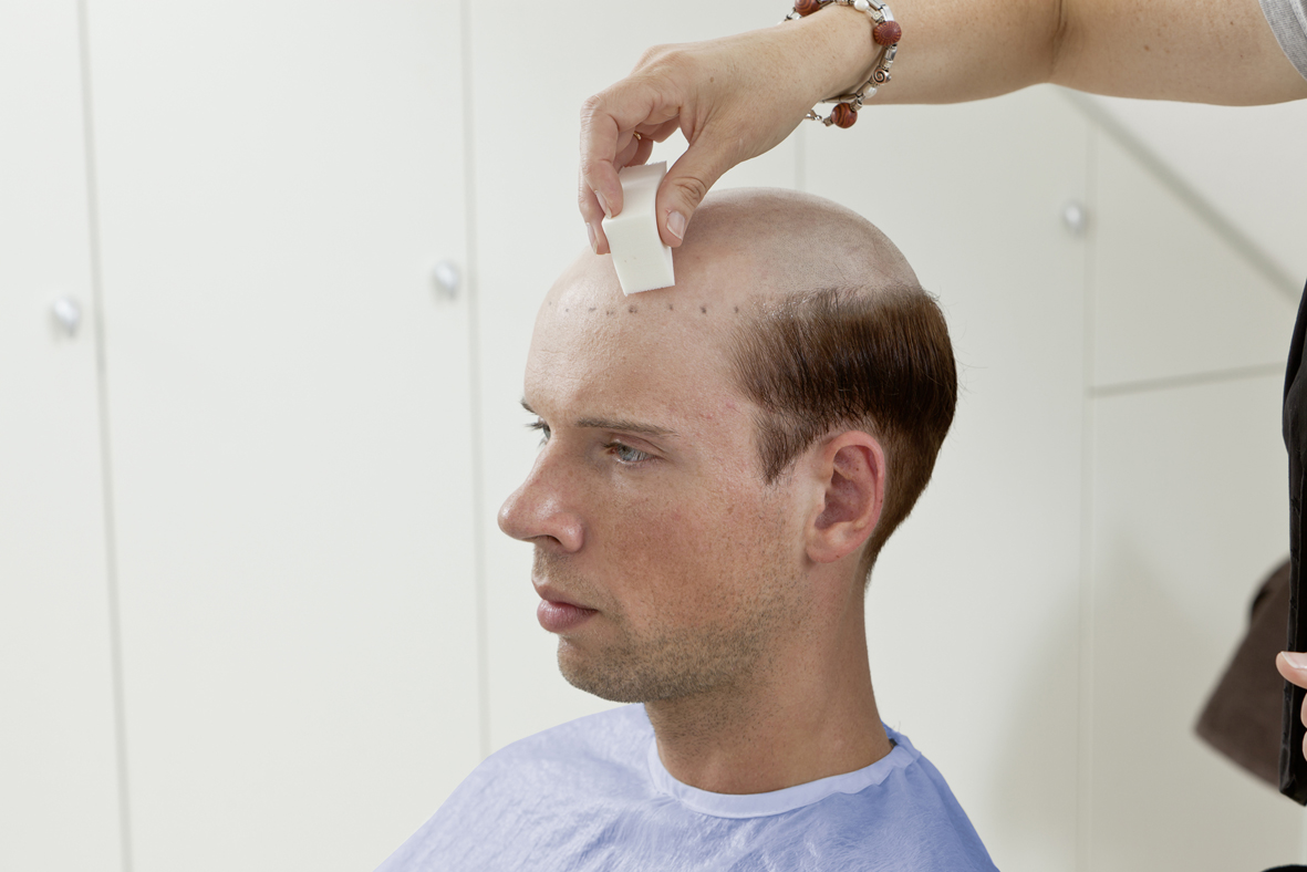 ContactSkin - Schritt 3 | Haarcenter Hess Zweithaarspezialist in Rosenheim