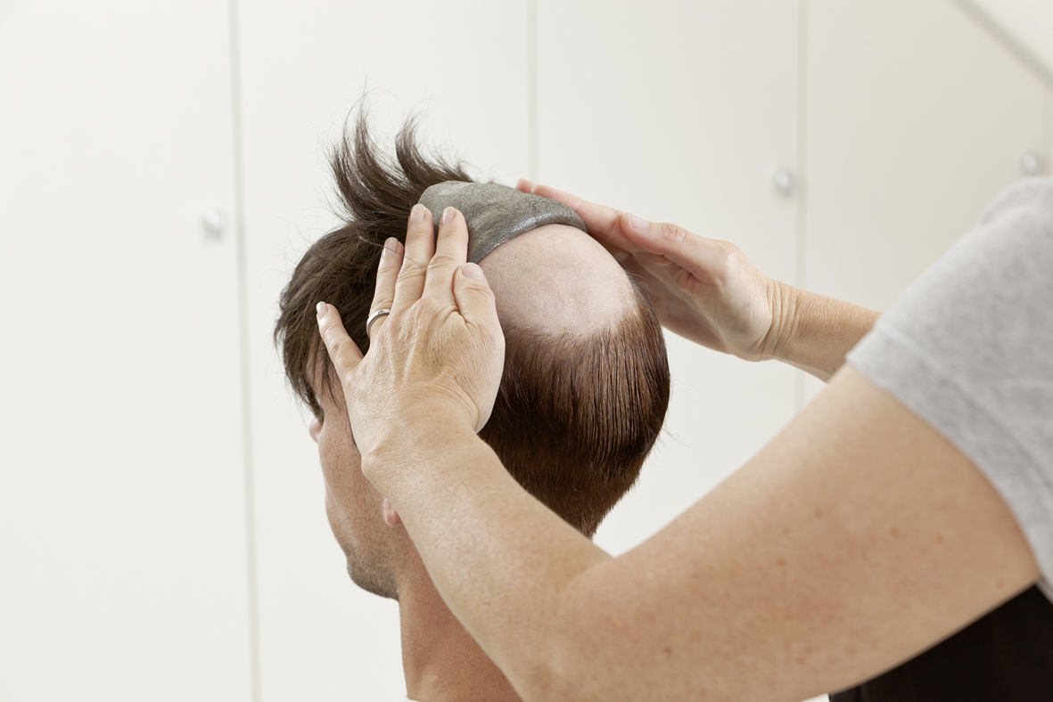 ContactSkin - Schritt 3 | Haarcenter Hess Zweithaarspezialist in Rosenheim