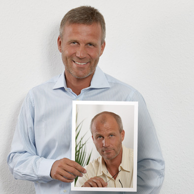 Zweithaarsystem für den Mann im Haarcenter Hess in Rosenheim