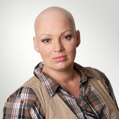 Superionix® vorher - Zweithaarberatung im Haarcenter Hess in Rosenheim