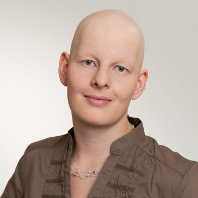 Superionix® vorher - Zweithaarberatung im Haarcenter Hess in Rosenheim